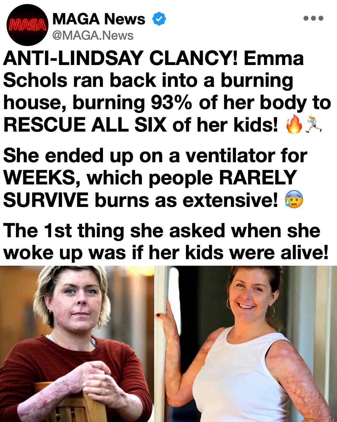 Defying the Flames: How One Mother Endured the Unthinkable to Save All Six of Her Children