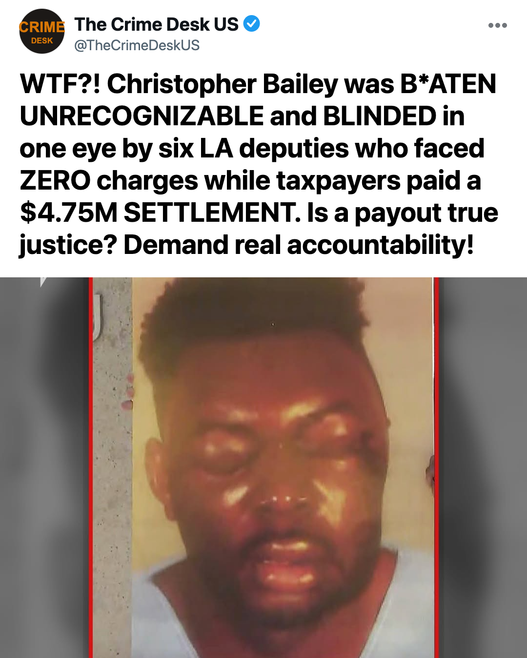 Six Deputies Beat a Driver Blind Over a Traffic Lane Infraction, Leaving Taxpayers to Pay the Millions