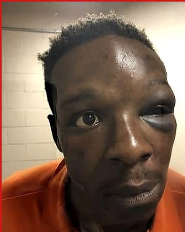 Pinned Down Over a Broken Taillight: The Brutal Arrest of Roderick Walker and the Justice System That Let His Assailant Walk Free