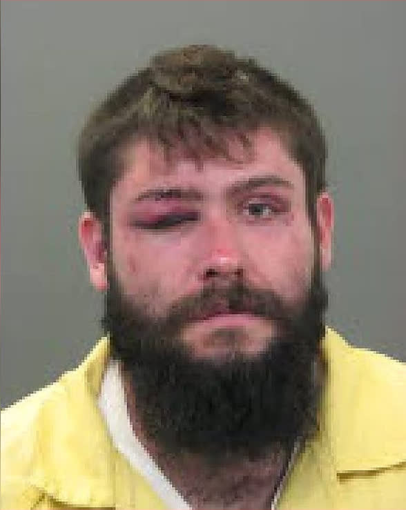 Bloodied Before The Arrest: Inside The Violent Feasterville Apartment Rampage That Took Four Officers To Stop