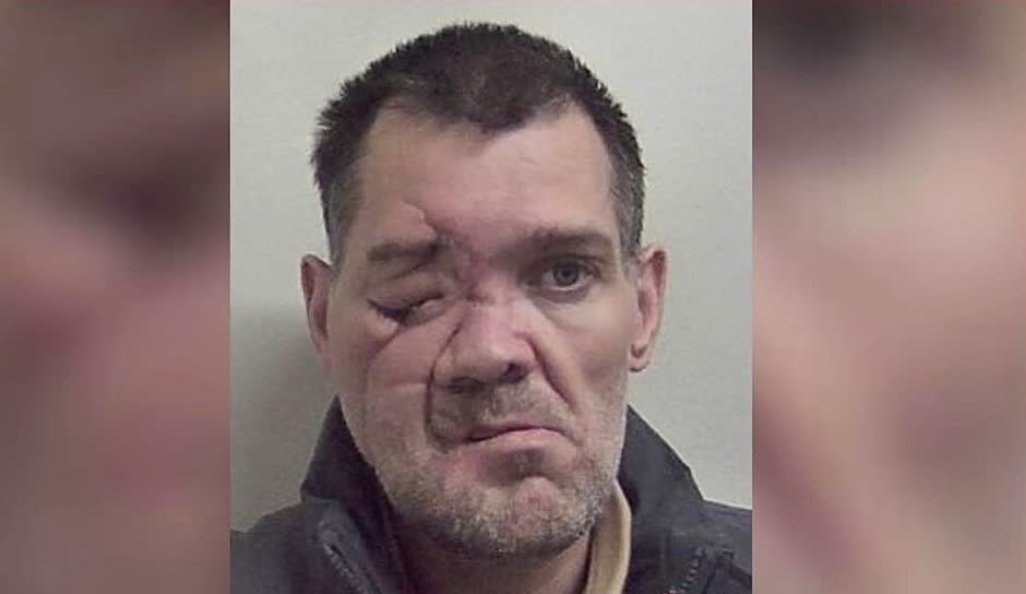 George Dunn Sentenced to Over Six Years After Hospital Self-Discharge and Multi-Town Kent Burglary Spree