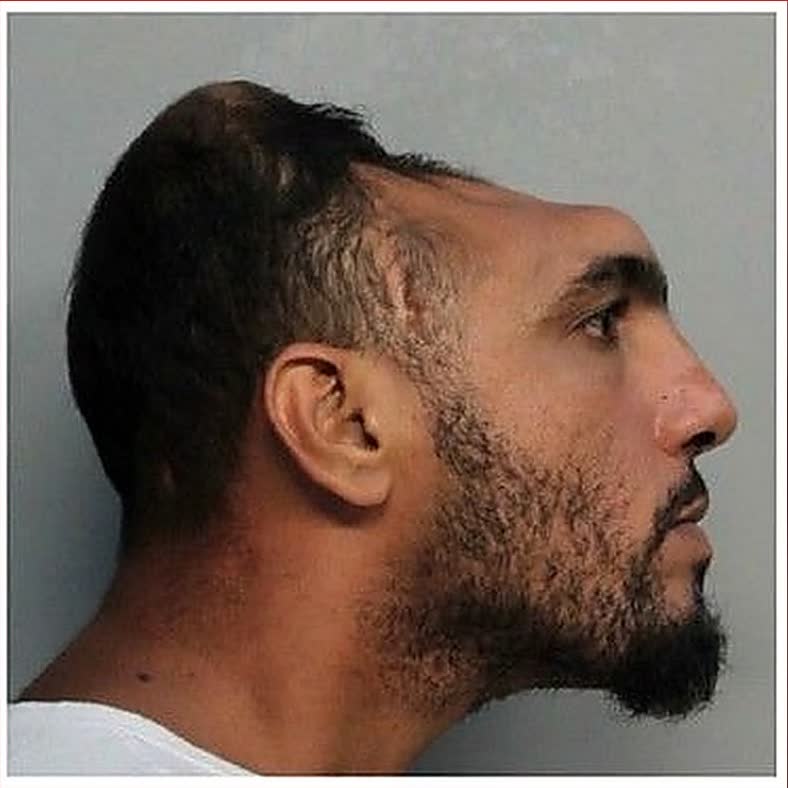 Viral Mugshot Subject Carlos Rodriguez Faced Arson and Attempted Murder Charges in Miami Duplex Fire