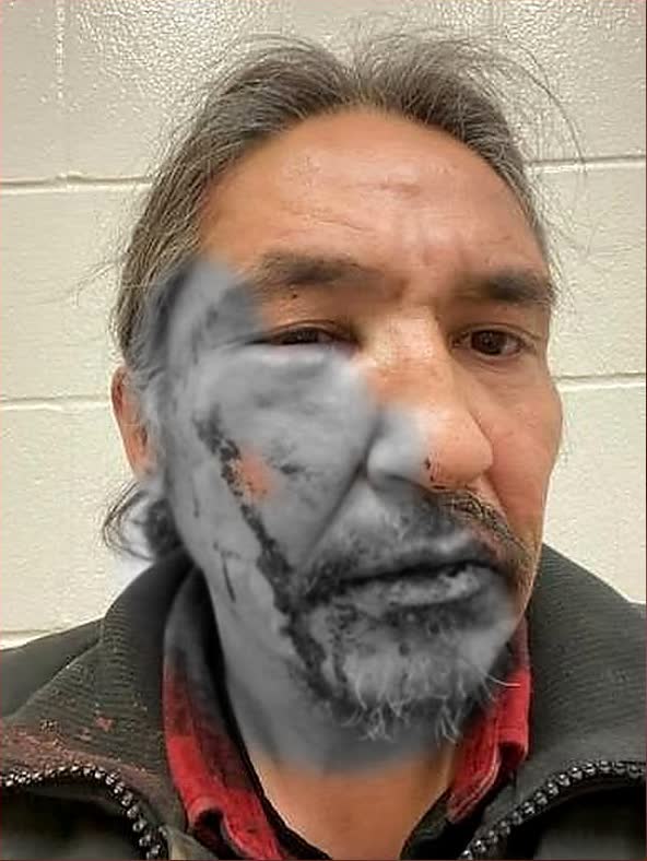 Alberta Mountie Simon Seguin who tackled Chief Allan Adam remained on duty despite assault charges