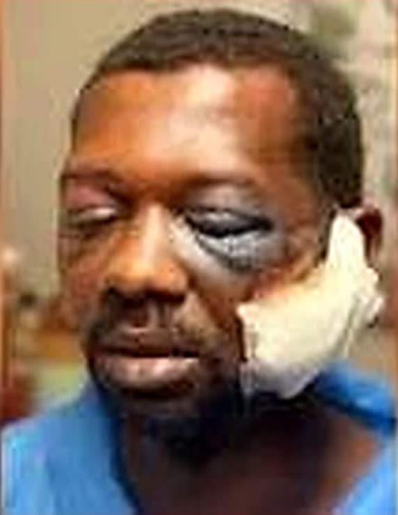 Twist in case of two Baytown officers indicted for felony assault after brutally beating Kedrick Crawford