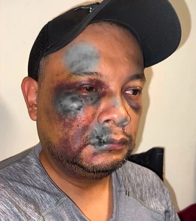 Arlington worker José Mejía Hernández, hospitalized with brain bleeding after immigration arrest, was blocked from MRI by ankle monitor